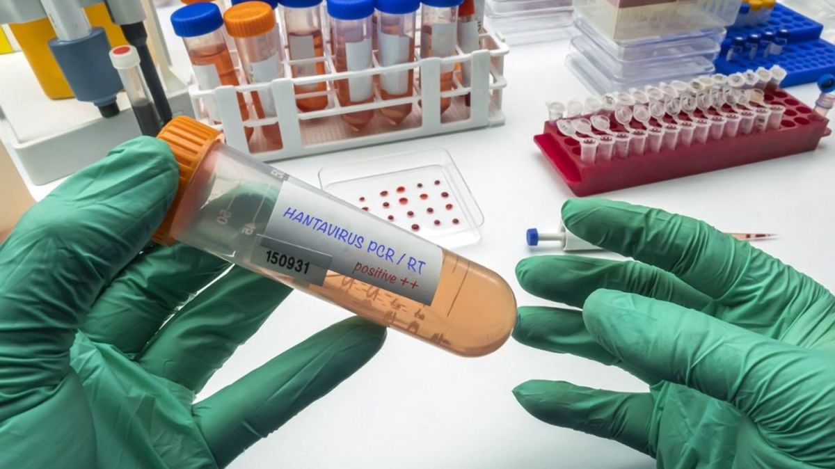 Entre anxiété et sérénité : les Français face à l'hantavirus